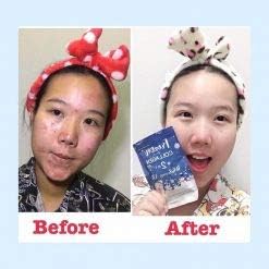Frozen Collagen Gluta 2In1 Skin Whitening X10 L-Glutathione Nourish The To Clear Reduce Freckles-8