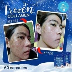 Frozen Collagen Gluta 2In1 Skin Whitening X10 L-Glutathione Nourish The To Clear Reduce Freckles-7