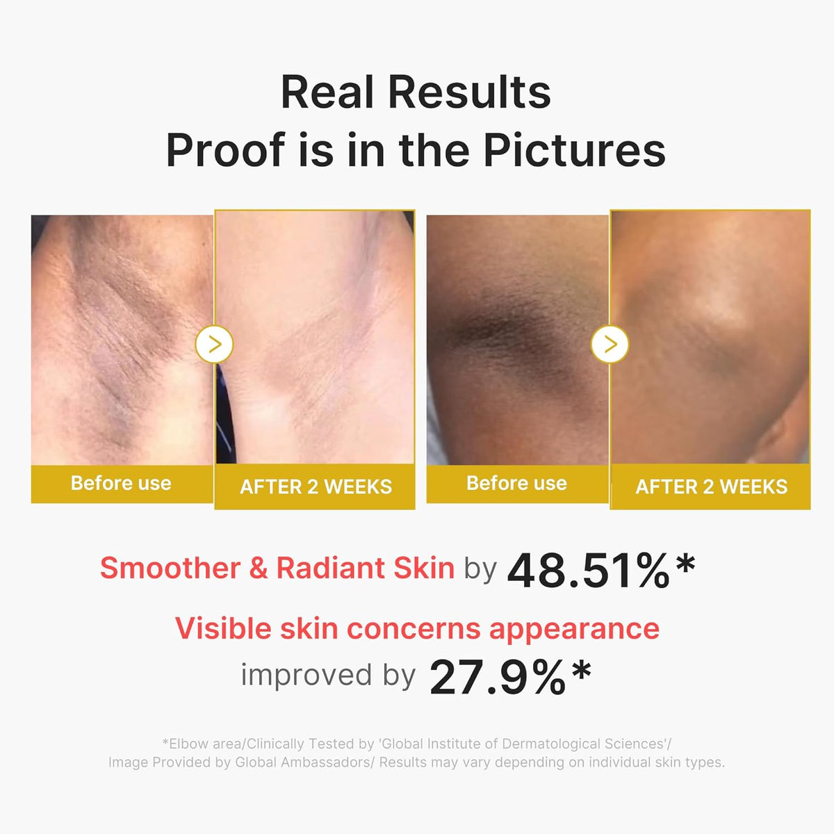 medicube Body Peel Shot with Kojic Acid and Turmeric 9.46 fl.oz-5