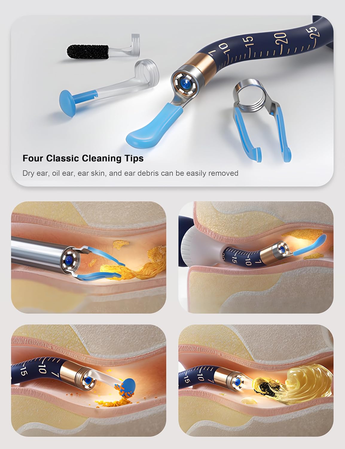 BEBIRD i35R, Earsight Plus Ear Wax Removal Tool Camera with HD Visual Otoscope-2