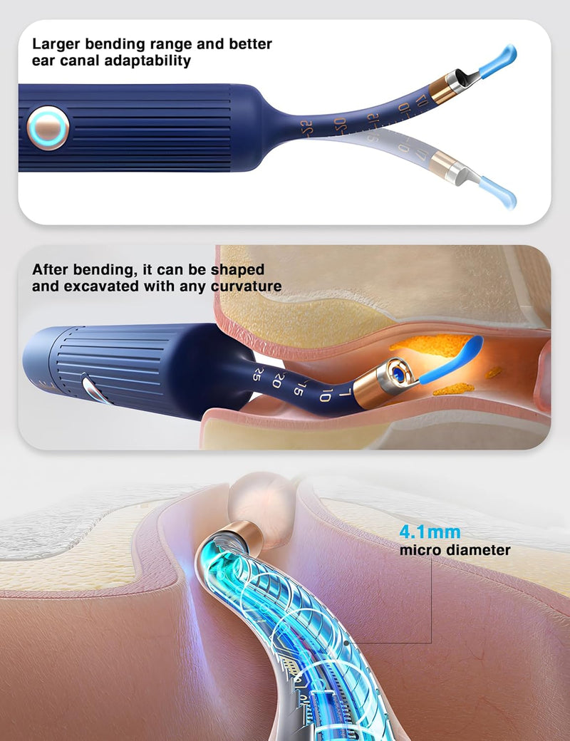 BEBIRD i35R, Earsight Plus Ear Wax Removal Tool Camera with HD Visual Otoscope-3