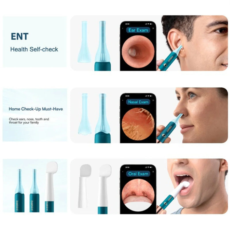 Bebird Earsight Ultra Ear Wax Removal Tool Camera, FSA HSA Eligible Items, 2K HD Ear Cleaner-6