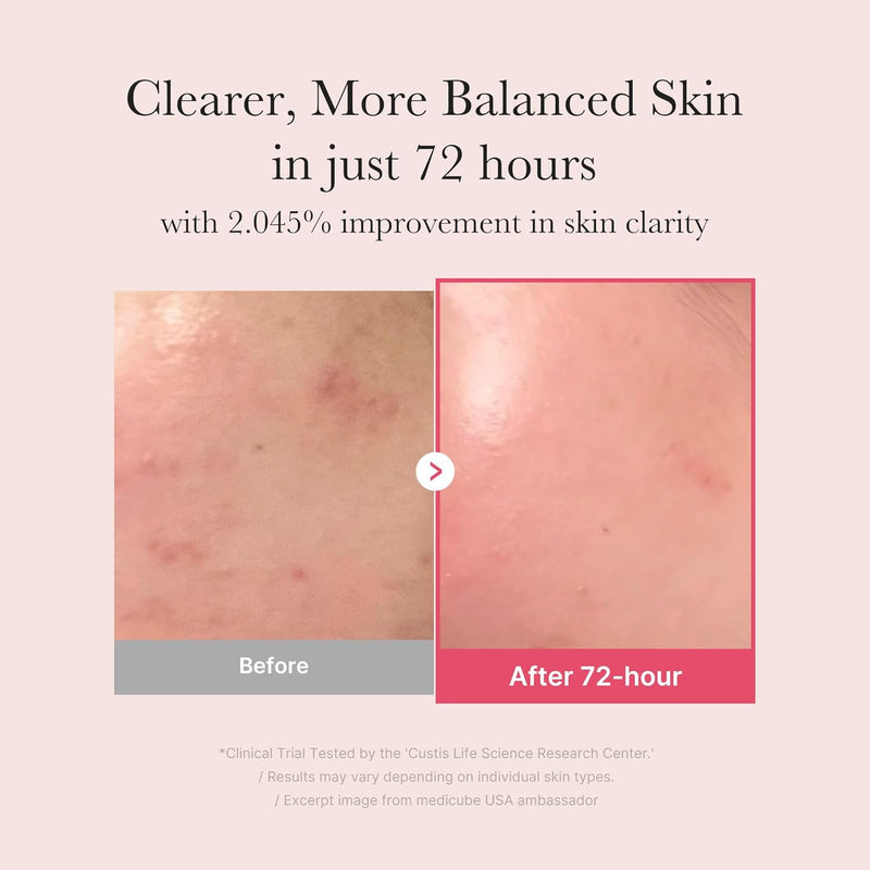 MediCube TXA+Niacinamide 15% Glow Serum-3