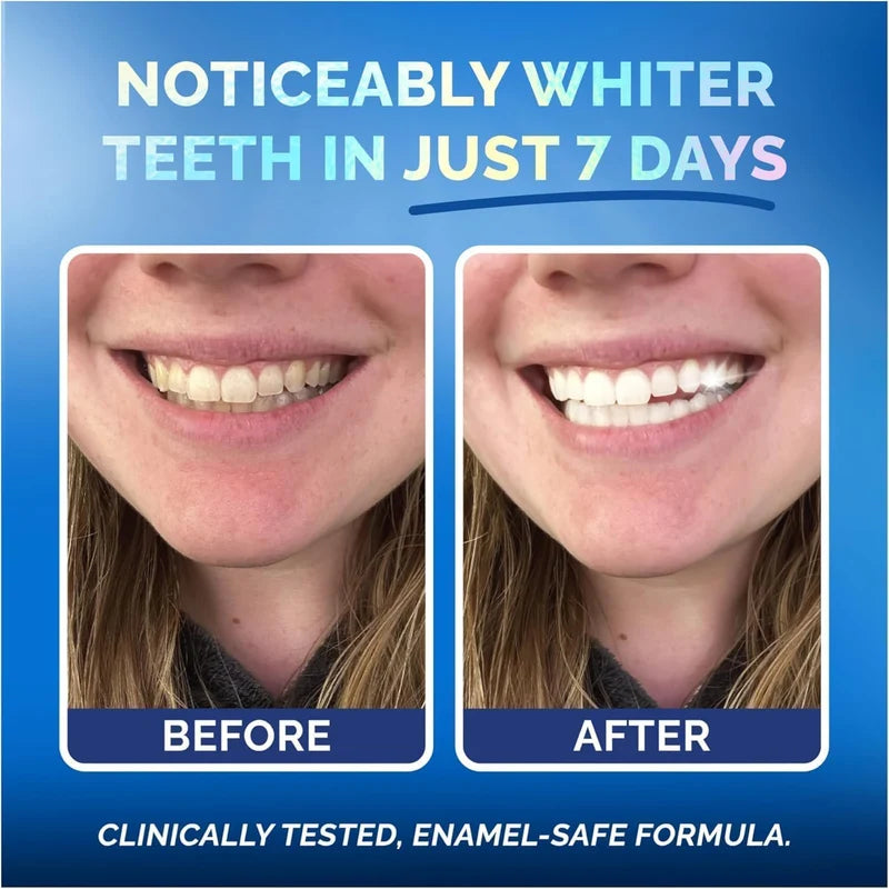 Pop On Teeth Whitening Strips – Peroxide-Free for Sensitive Teeth & Gums | Mint Flavor | 14 Strips / 7 Treatments-3